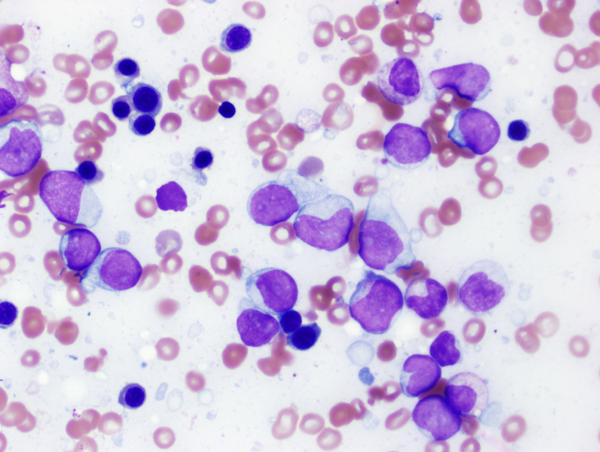 BM Aspirate